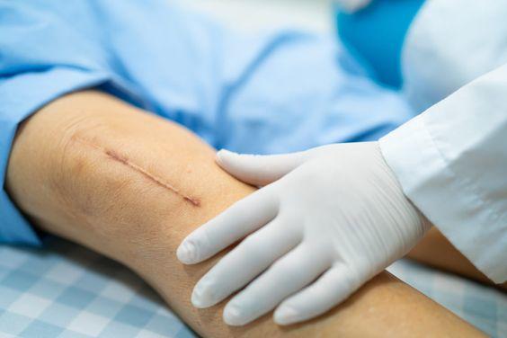 How to deal with postoperative wound scars?