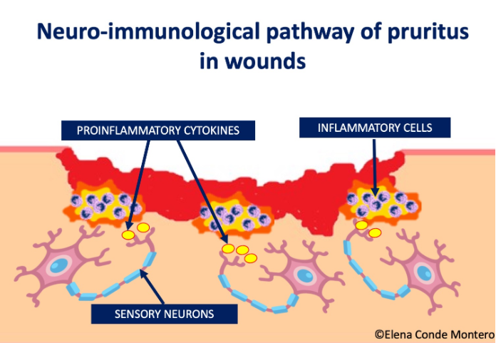 itchy wound