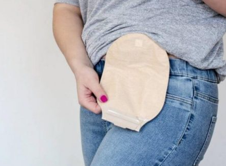 ostomy pouch