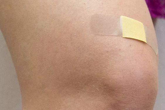 What should I do if the wound becomes itchy after scabbing?