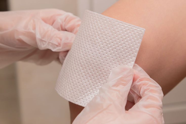 USC and Caltech jointly develop smart bandages to revolutionize chronic wound treatment