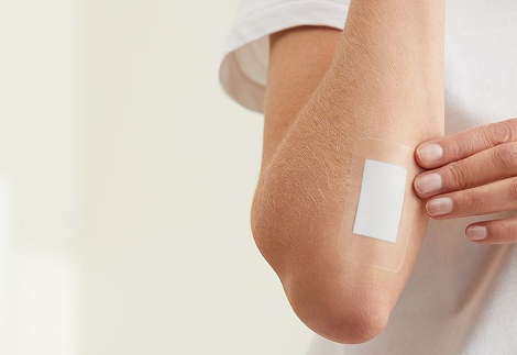 Innovative sensor technology: a revolutionary breakthrough in wound healing monitoring